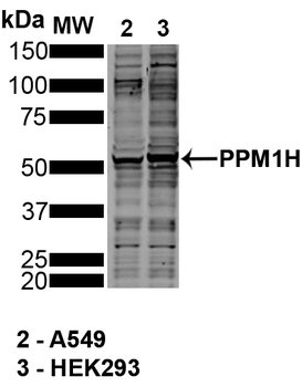 PPM1H Antibody: Biotin