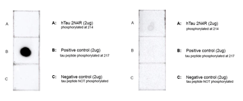 Tau Antibody (pThr217): RPE