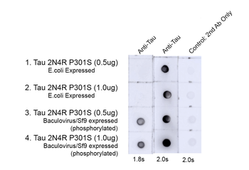 Tau Antibody (pThr217): RPE