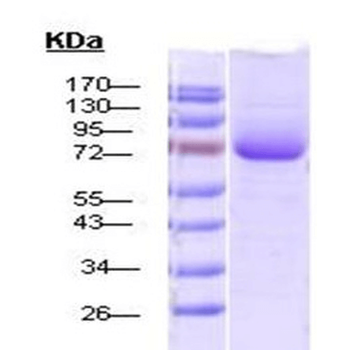 HSP70 Protein