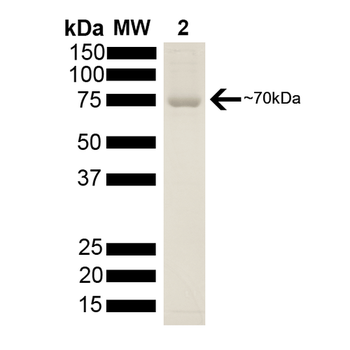 HSP70 Protein