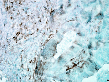 HSP25/HSP27 Antibody: HRP
