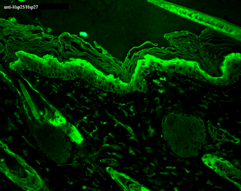HSP25/HSP27 Antibody: HRP