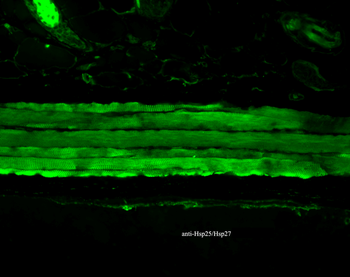 HSP25/HSP27 Antibody: HRP