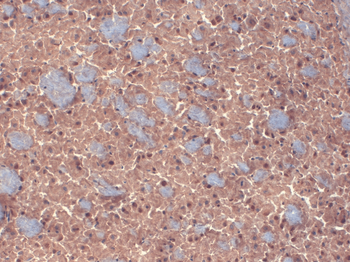 GABA-A Receptor Beta 3 Antibody: APC