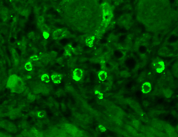 GABA A Receptor Antibody (RPE)