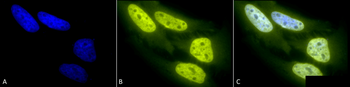 Acetylated Lysine Antibody