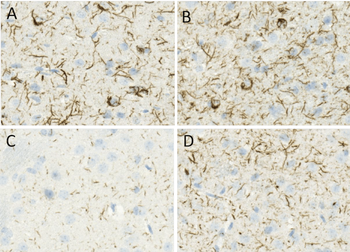 Alpha Synuclein Pre-formed Fibrils (Type 1)