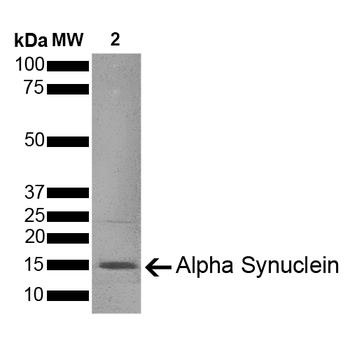 Alpha Synuclein Pre-formed Fibrils (Type 1)
