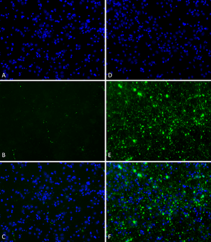 Alpha Synuclein Pre-formed Fibrils (Type 1)