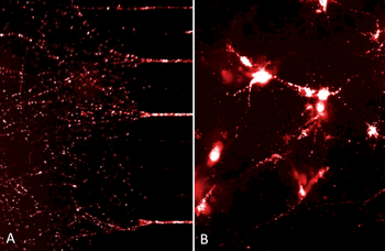 Alpha Synuclein Pre-formed Fibrils (Type 1)