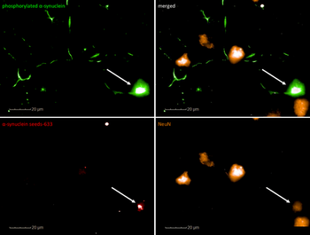 Alpha Synuclein Pre-formed Fibrils (Type 1)