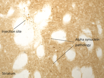 Alpha Synuclein Pre-formed Fibrils (Type 1)