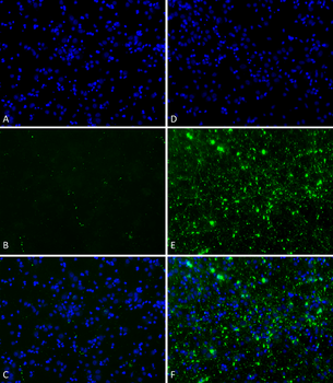 Alpha Synuclein Pre-formed Fibrils (Type 2)