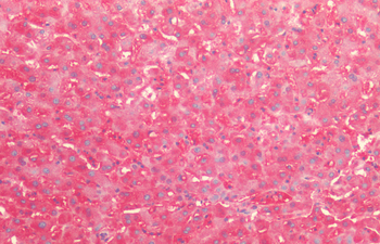 HSP60 (P. falciparum) Antibody