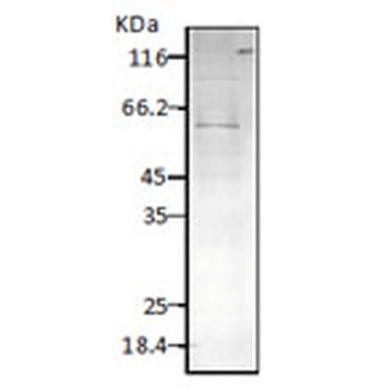 HSP60 (P. falciparum) Antibody