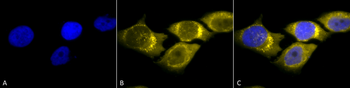 SOD2 (Mn) Antibody