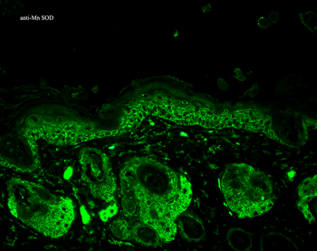 SOD2 (Mn) Antibody