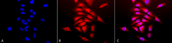 SOD1 (Cu/Zn) Antibody