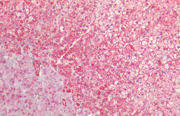 HSP60 Antibody
