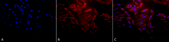 HSP60 Antibody