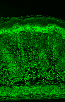 HIF 1 alpha Antibody