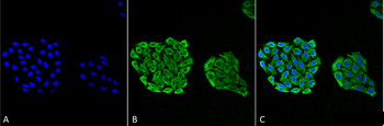 HSP70 Antibody