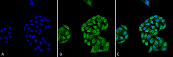 HSP70 Antibody