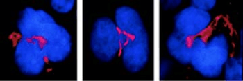 FKBP51 Antibody