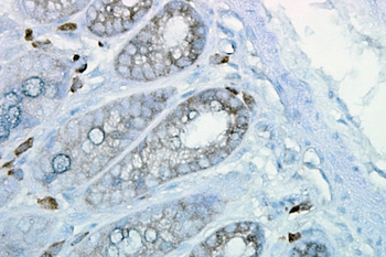 HSP90 Antibody