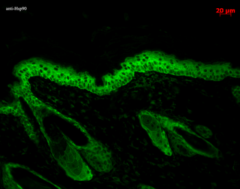 HSP90 Antibody