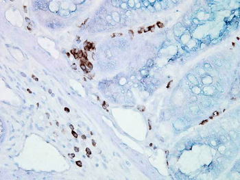 HSP70/HSC70 Antibody
