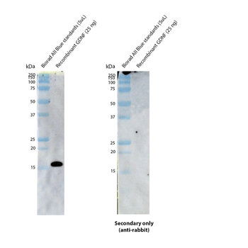 GDNF Antibody (RPE)