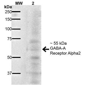GABA A Receptor Antibody (RPE)