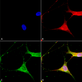 Kir6.1 Antibody (RPE)