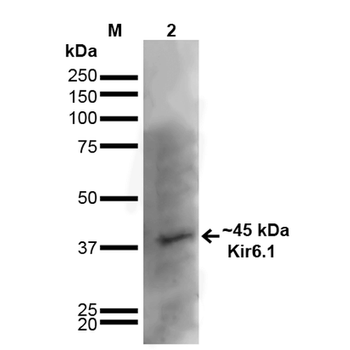 Kir6.1 Antibody (RPE)