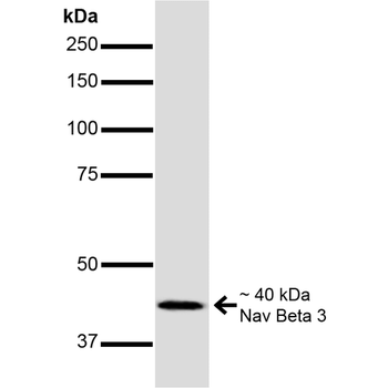 NaVbeta3 Antibody (PerCP)