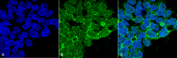 PP5 Antibody (RPE)