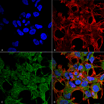 GABARAP Antibody
