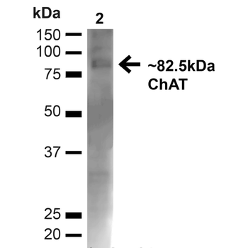 Choline Acetyltransferase Antibody (Biotin)