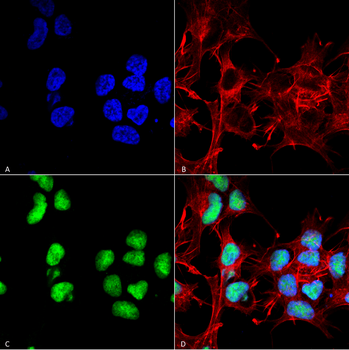 Choline Acetyltransferase Antibody (RPE)