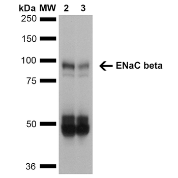ENaC beta Antibody: HRP