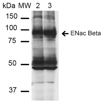 ENaC beta Antibody: HRP