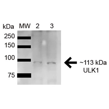 ULK1 Antibody: FITC