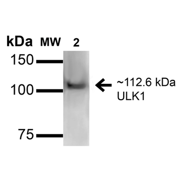 ULK1 Antibody (RPE)