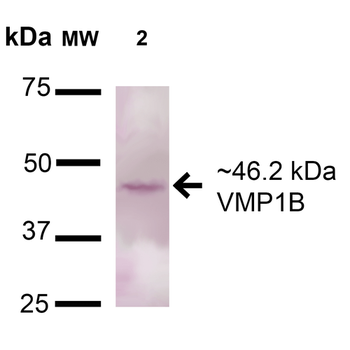 VMP1 Antibody: PerCP