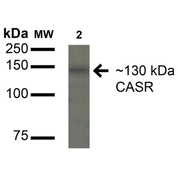 Calcium Sensing Receptor Antibody: Biotin
