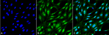 Ubiquitin Antibody