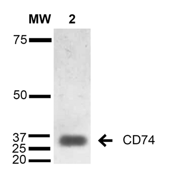 CD74 Antibody: HRP