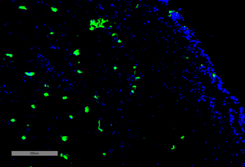 Acrolein Antibody (RPE)